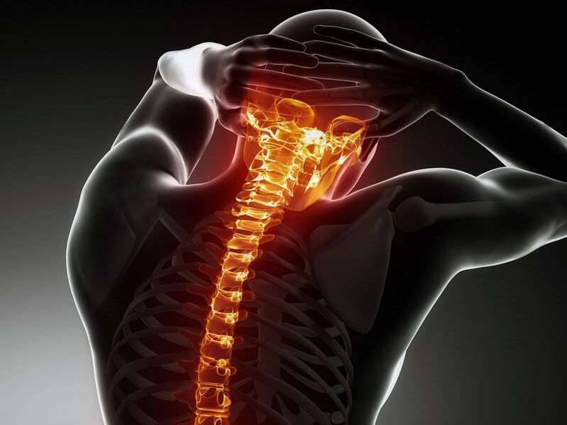 Objawy osteochondrozy