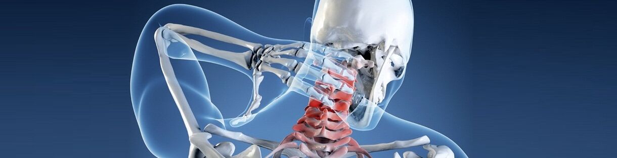 Osteochondroza ludzkiego kręgosłupa szyjnego