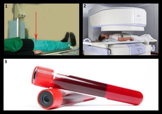 Metody diagnozowania choroby zwyrodnieniowej stawów - RTG i MRI stawu biodrowego, badanie krwi