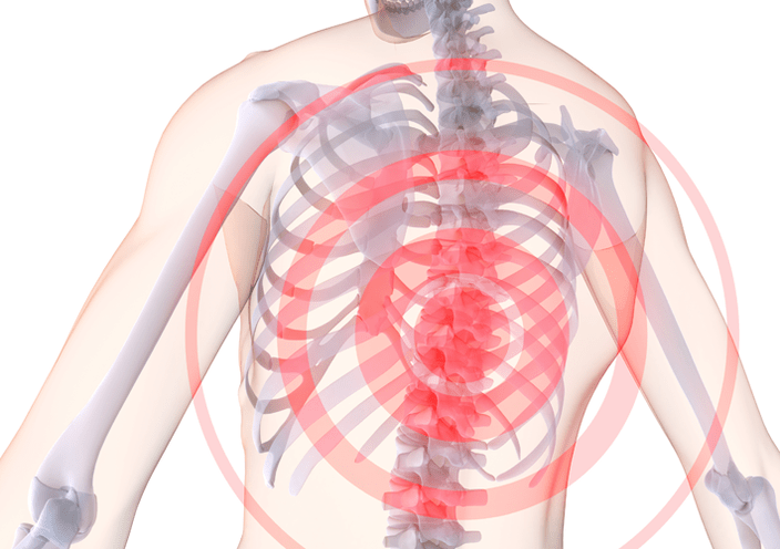 osteochondroza odcinka piersiowego kręgosłupa