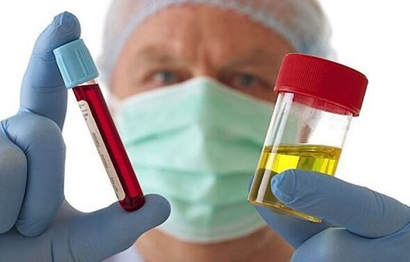 Sposoby zdiagnozowania osteochondrozy kręgosłupa szyjnego