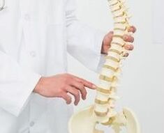 osteochondroza lędźwiowa