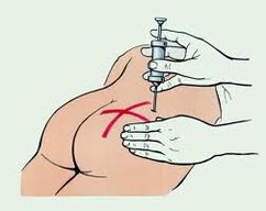 zastrzyk w leczeniu osteochondrozy